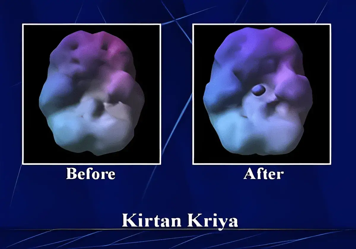 Forskning visar hur Kirtan Kriya påverkar hjärnan. Bilden visar en hjärnmodell före och efter övningen.