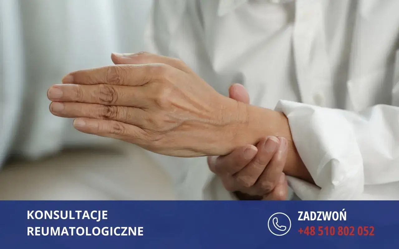 Dłonie z widocznymi objawami RZS. Zapytaj, rzs ile się żyje, i jak sobie z tym radzić.