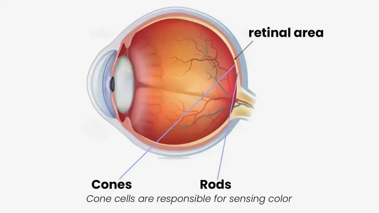 Sezione trasversale dell'occhio che mostra coni e bastoncelli nella retina. La distrofia dei coni colpisce queste cellule visive.