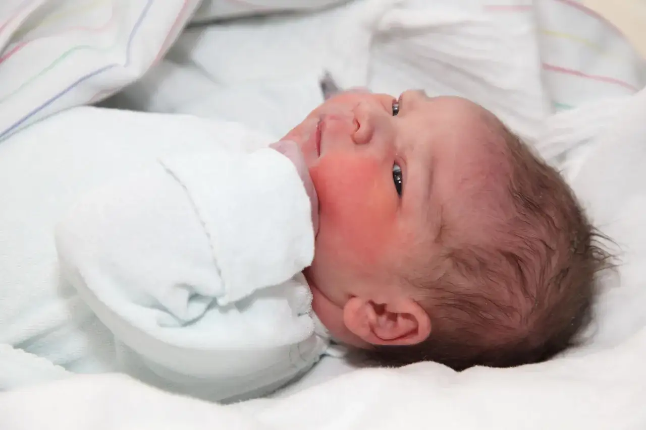 Neugeborenes Baby mit leicht verformter Kopfform nach der Geburt, vielleicht mit Saugglocke.