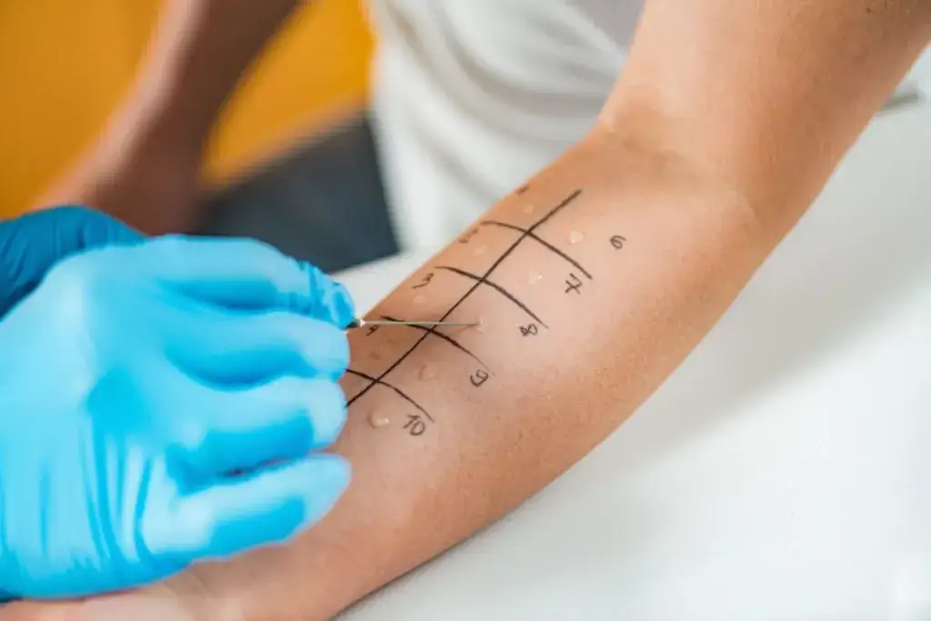 immunoterapia odczulanie