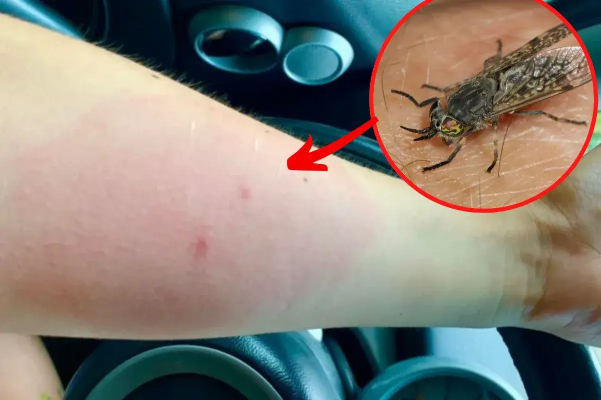 Obrzęk i zaczerwienienie na ramieniu po ugryzieniu muchy końskiej. W powiększeniu widać owada na skórze.