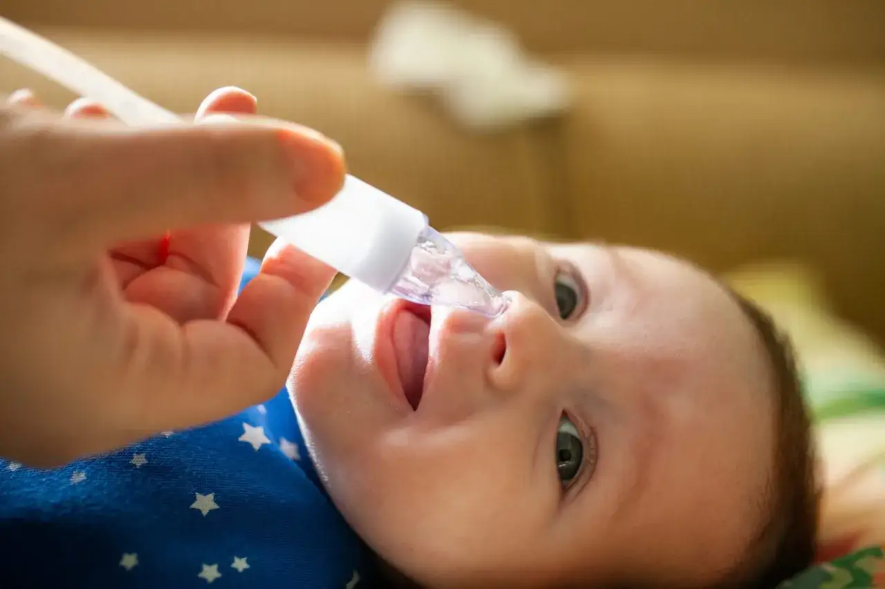 Un bebé recibe un aspirador nasal, un método para aliviar la congestión, útil entre los remedios caseros para la tos en bebés.