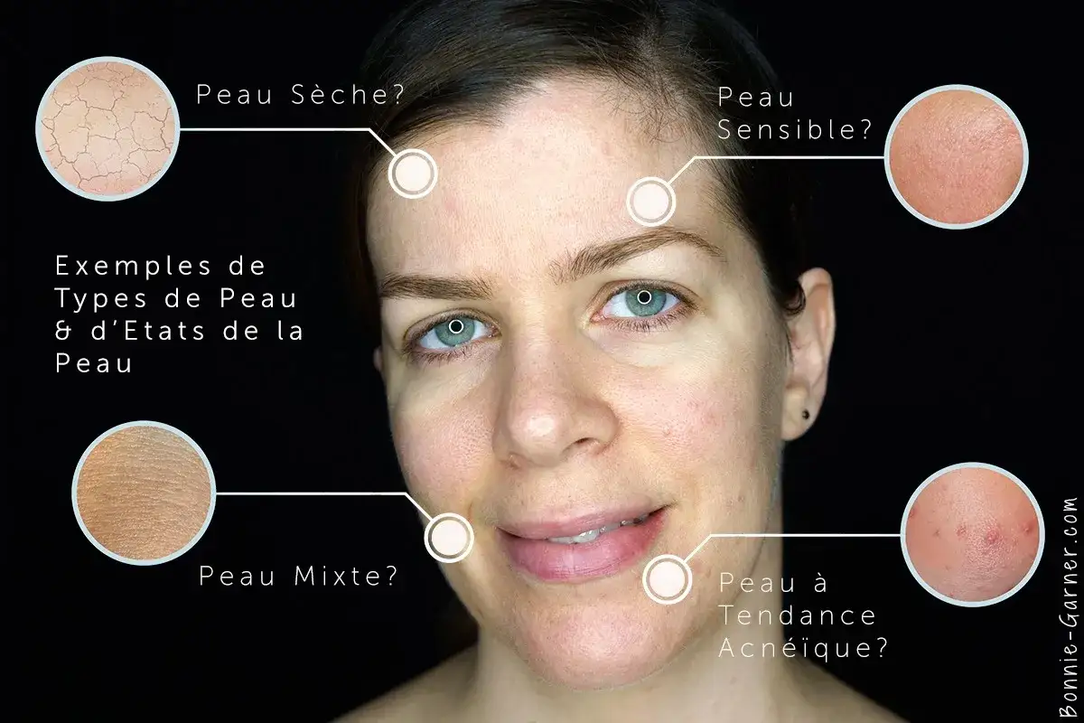 Comment savoir si on a la peau grasse ? Cette image montre des exemples de types de peau : sèche, sensible, mixte et à tendance acnéique.