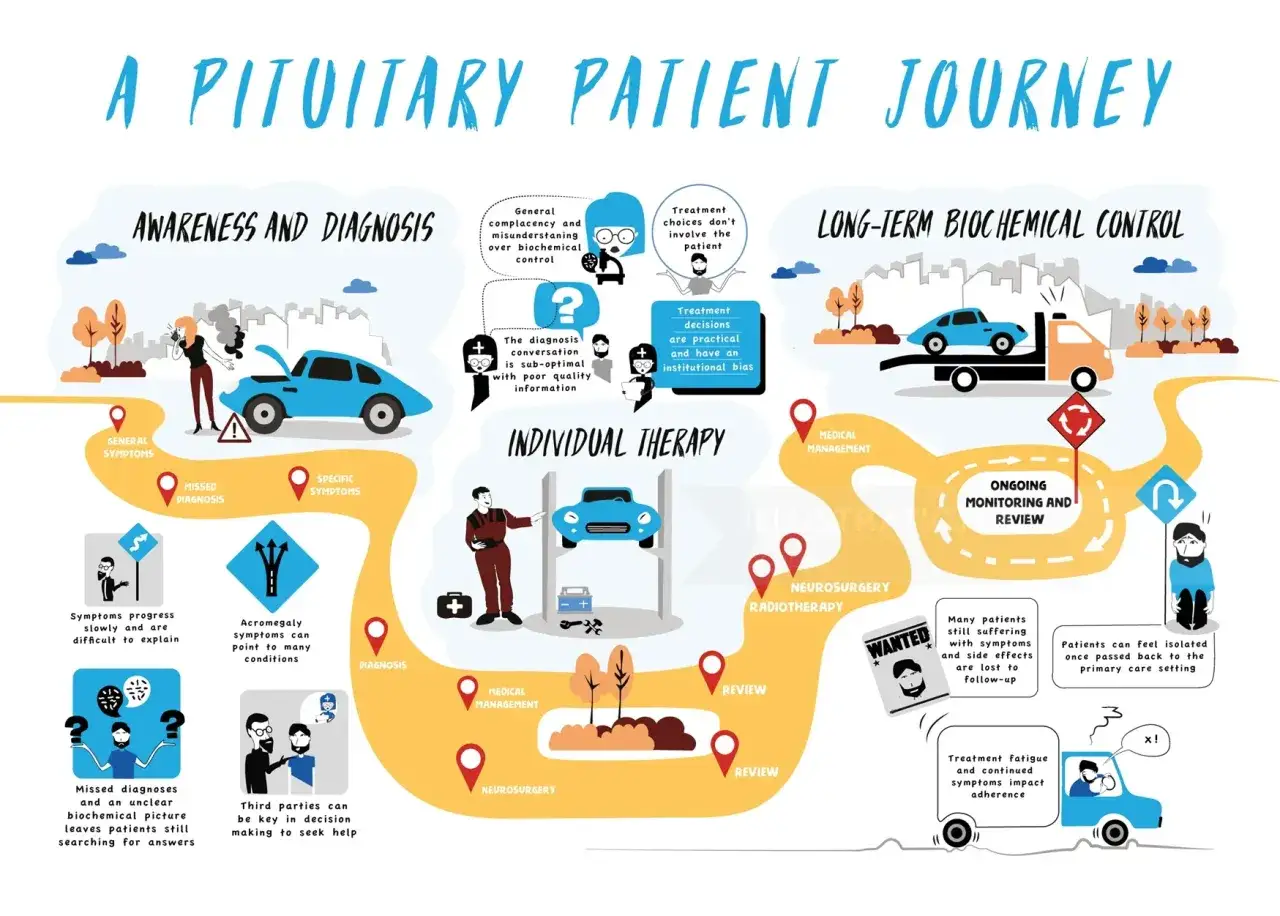 Ilustracja przedstawia podróż pacjenta z guzem przysadki: od diagnozy, przez terapię, po długoterminową kontrolę. Rekonwalescencja po operacji guza przysadki jest kluczowa.