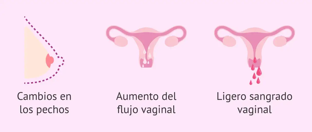 Cambios en pechos, flujo y sangrado vaginal. Si no me baja la regla y estoy muy hinchada, estos pueden ser los s&iacute;ntomas.