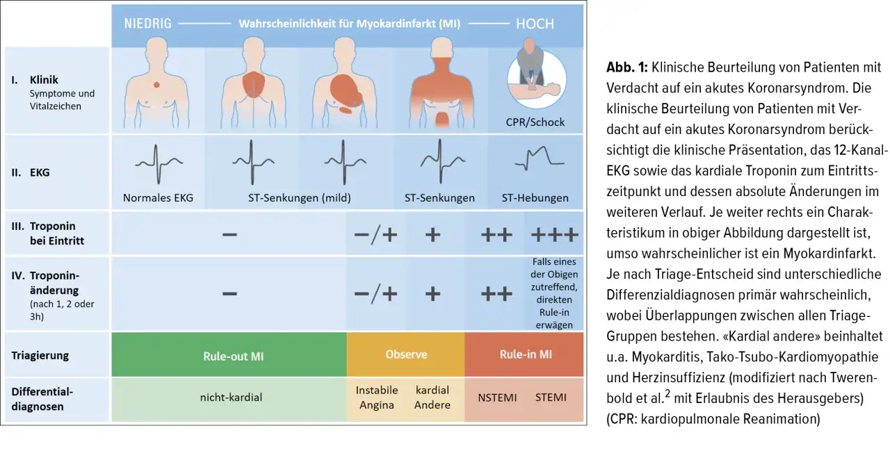 Zdjęcie Myokardinfarkt Diagnostik: Wichtige Tests und Symptome erkennen