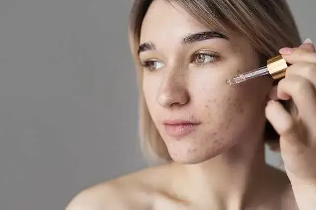 Zdjęcie Jakie serum do cery mieszanej pomoże zniwelować nadmiar sebum?