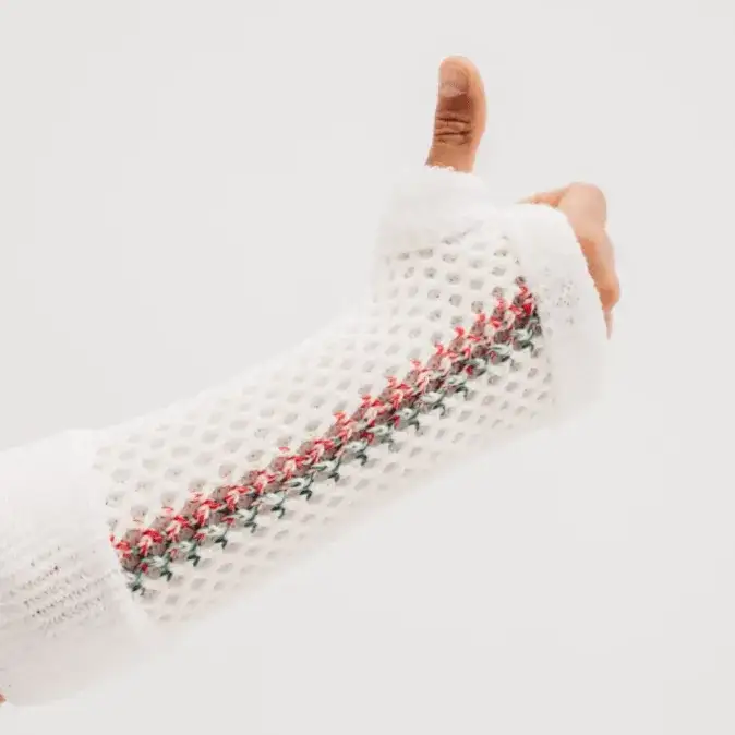 Zdjęcie Gdzie kupić gips HM CAST? Sprawdzone miejsca i najlepsze oferty