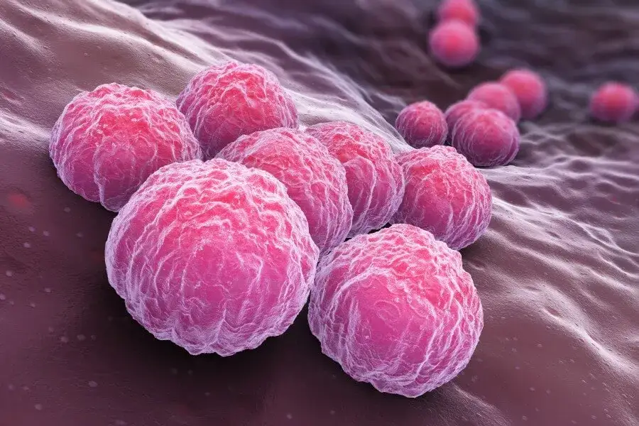 Zdjęcie Chlamydia pneumoniae objawy neurologiczne: rzadkie, ale groźne skutki