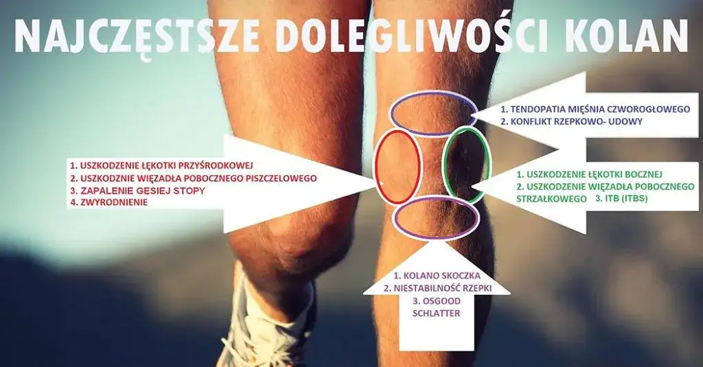 Zdjęcie Jak leczyć ból kolan po treningu? Skuteczne metody i porady na szybką ulgę