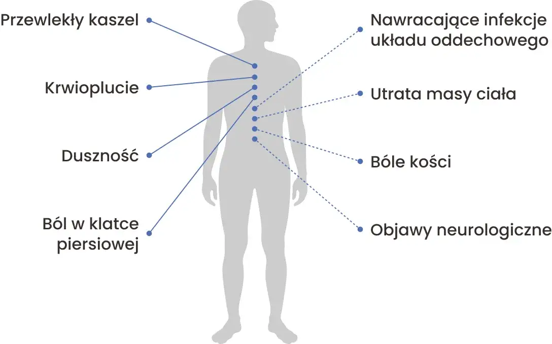Zdjęcie Objawy nowotworu płuc – nie bagatelizuj tych niepokojących sygnałów