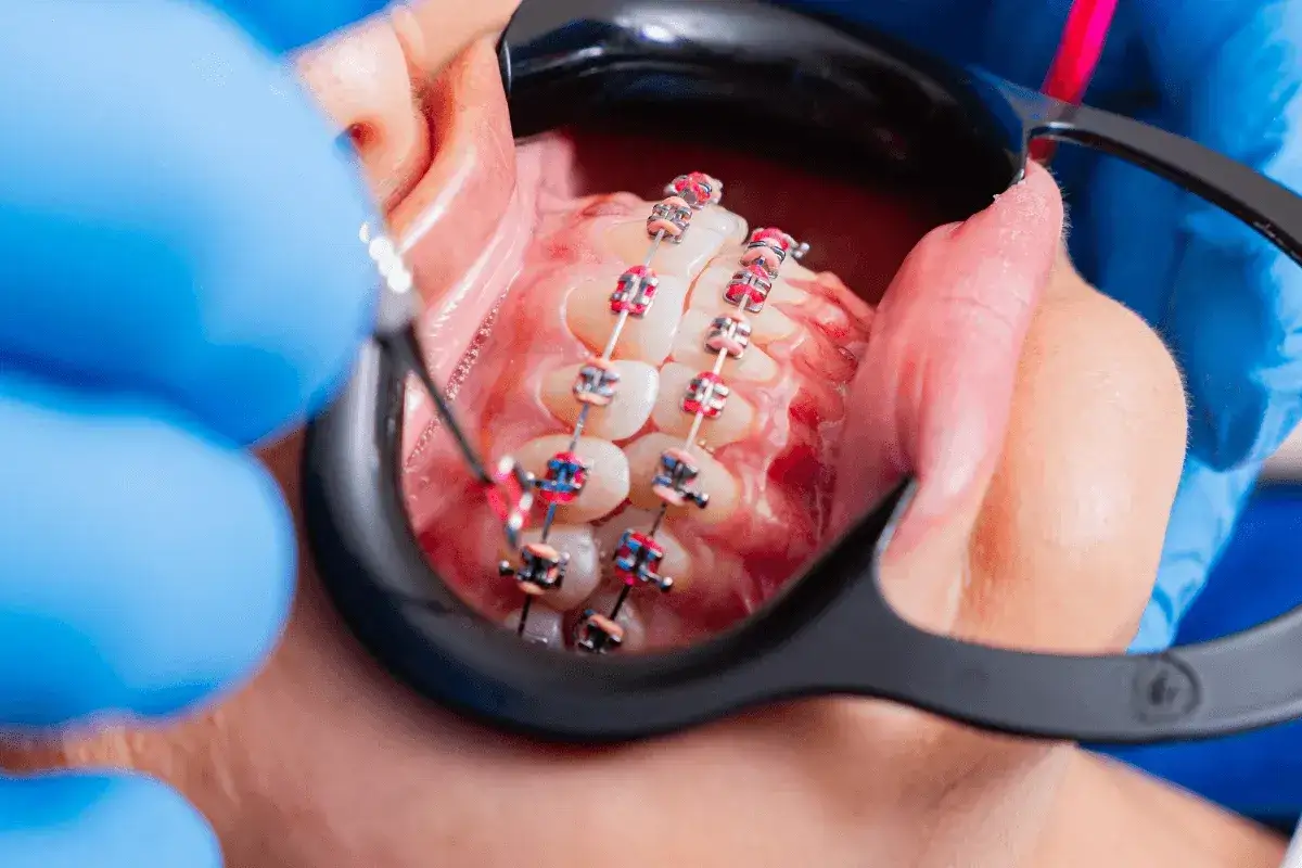 Zdjęcie Co dentysta widzi? Więcej niż myślisz - poznaj prawdę