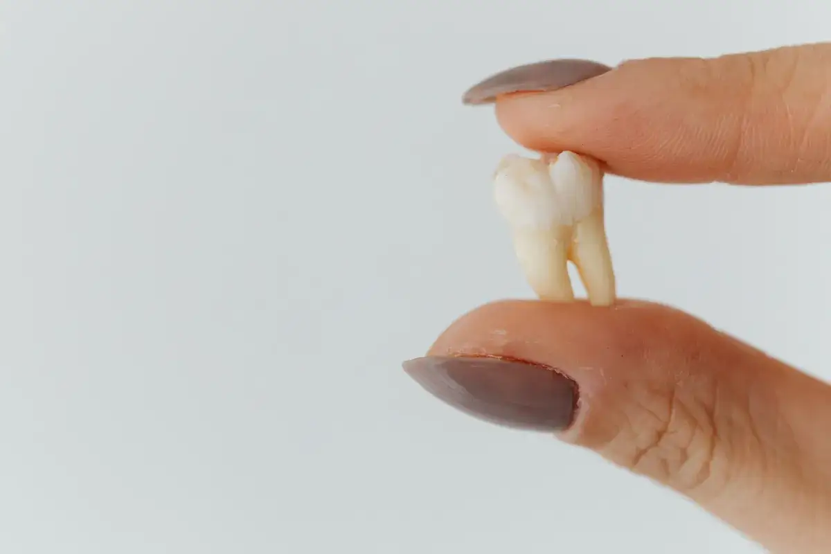 Zdjęcie Co dentysta robi z wyrwanym zębem? Oto co musisz wiedzieć