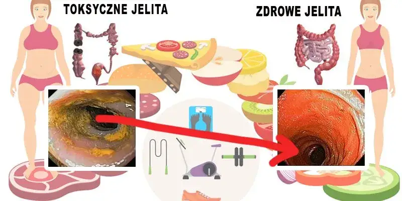 Zdjęcie Przepisy na zdrowe jelita, które poprawią Twoje trawienie i samopoczucie