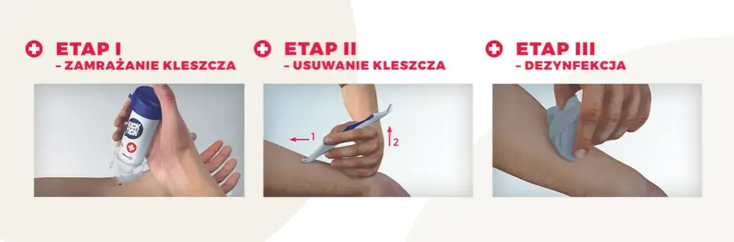 Zdjęcie Jak uniknąć boreliozy? Praktyczny poradnik ochrony przed kleszczami