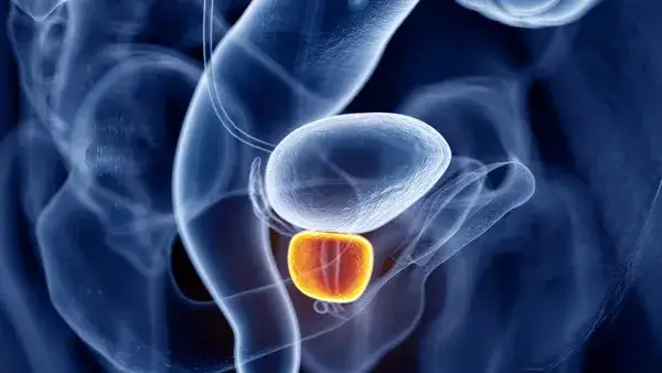 Zdjęcie Czy rak prostaty daje przerzuty? Poznaj niebezpieczeństwa i objawy
