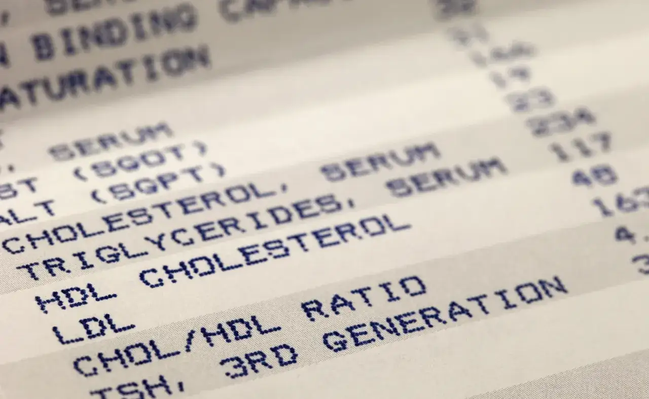 Zdjęcie Czy tabletki na cholesterol odchudzają? Prawda o ich wpływie na wagę