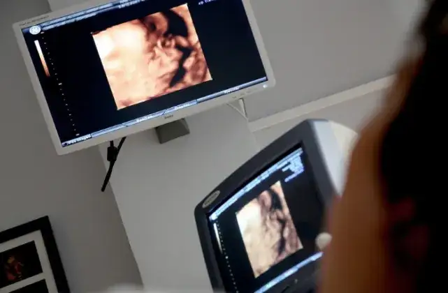 Zdjęcie Czy i kiedy na pogotowiu robią USG? Fakty i mity o badaniach