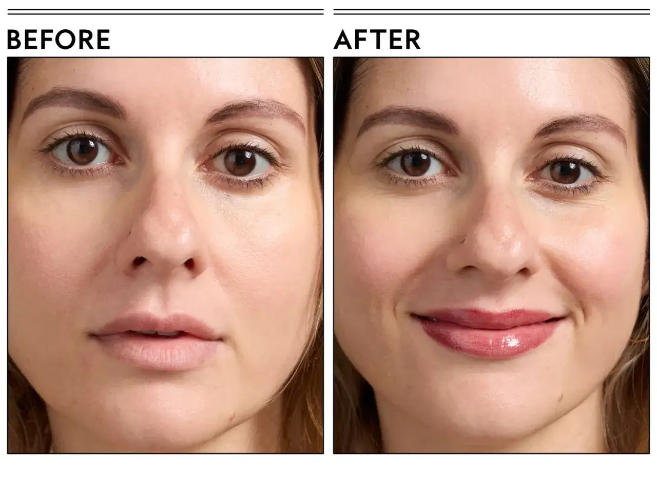 Prima e dopo: labbra pi&ugrave; piene dopo l'uso di un lip plumper. Nessun effetto collaterale visibile.