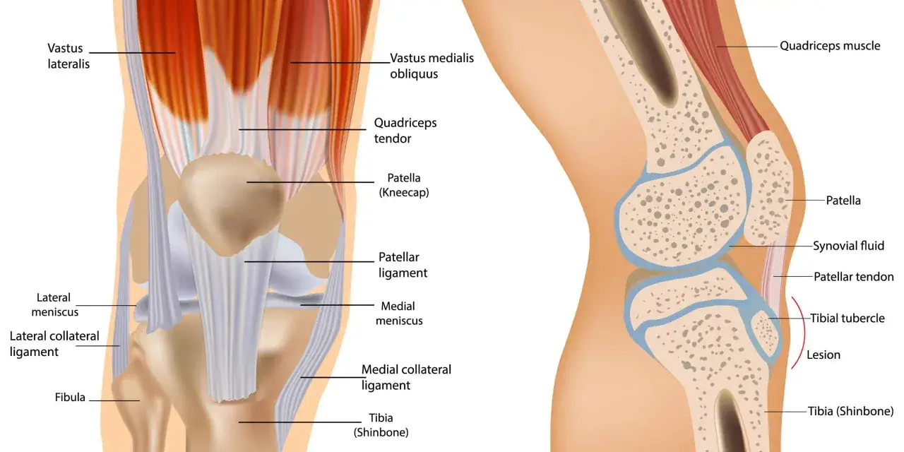 Anatomia stawu kolanowego: mięśnie czworogłowe uda, więzadła, łąkotki i kości. Widoczna patella (rzepka) i jej więzadło.