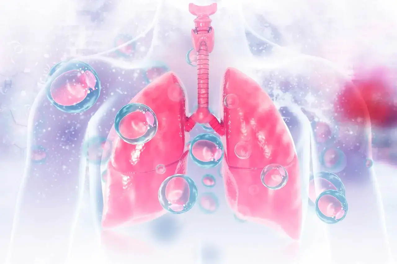 Pulmones rosados con burbujas que sugieren que el vaper encharca los pulmones, afectando su salud.