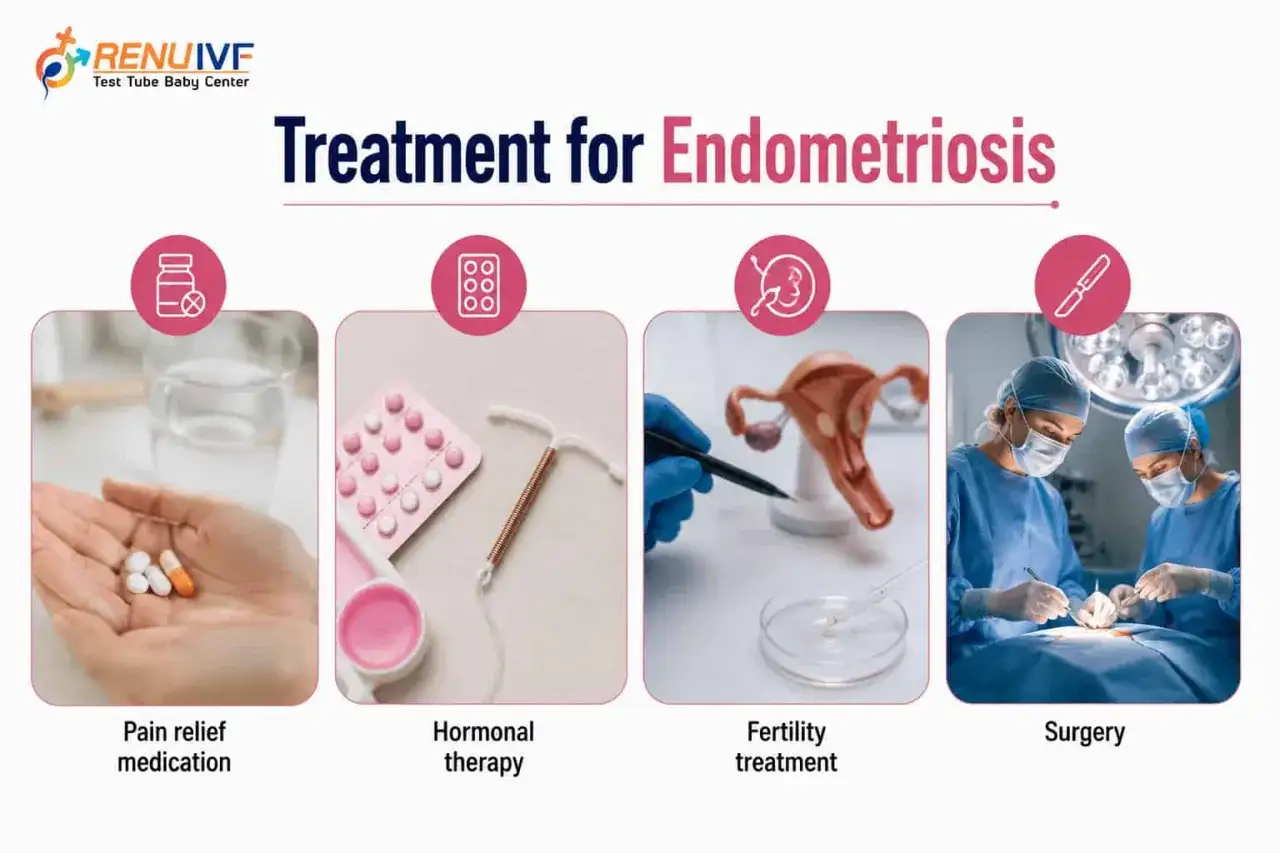 Leczenie endometriozy: leki przeciwbólowe, terapia hormonalna, leczenie niepłodności i chirurgia.