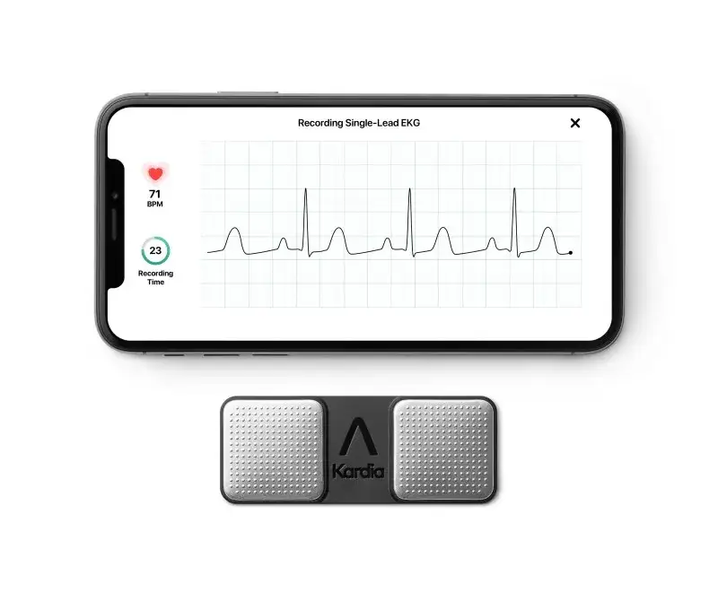 KardiaMobile 6L Messung