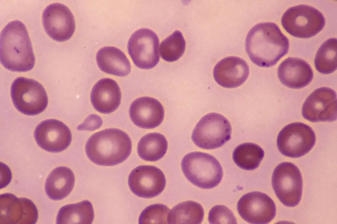Mikroskopowy obraz krwinek czerwonych. Morfologia RBC, czyli badanie kształtu i wielkości krwinek, jest kluczowe dla diagnozy.