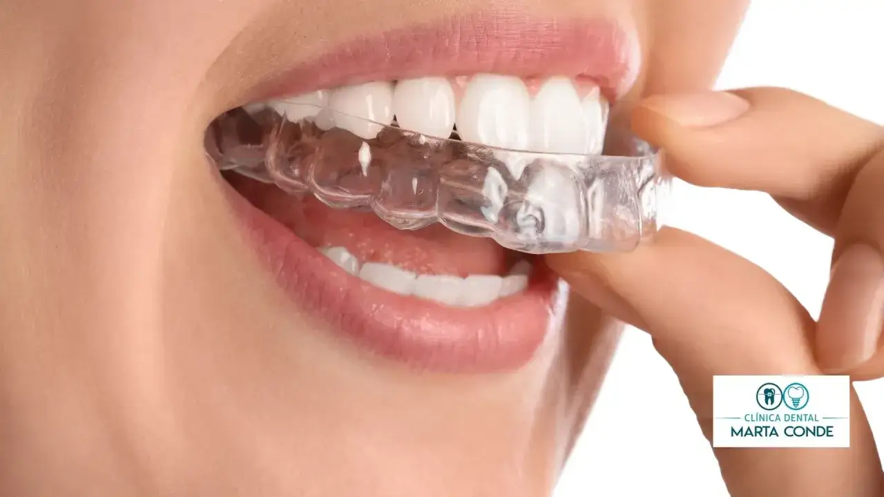 Sonrisa perfecta con Invisalign. Consulta el precio invisalign Sanitas y luce tu mejor sonrisa.