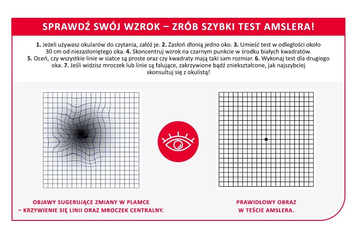 Test Amslera pokazuje zniekształcone linie i mroczek centralny, co może sugerować zmiany w plamce żółtej.
