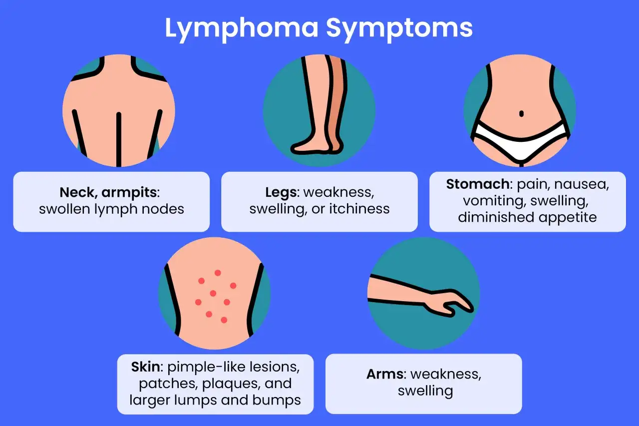 Übersicht der Symptome von Lymphomen: geschwollene Lymphknoten im Nacken/Achseln, Hautveränderungen, Magenbeschwerden, Schwäche in Armen/Beinen.