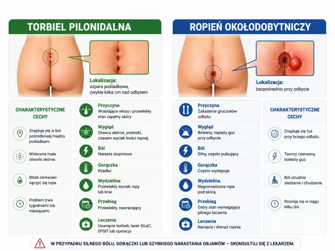 Torbiel pilonidalna to schorzenie z wrastającymi włosami, tworzące otwory skórne między pośladkami.