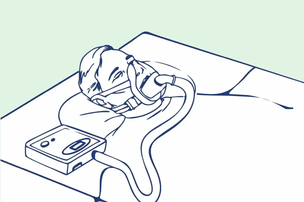 Osoba śpi z maską CPAP. Czy przy wysokim ciśnieniu chce się spać? Urządzenie wspomaga oddychanie.
