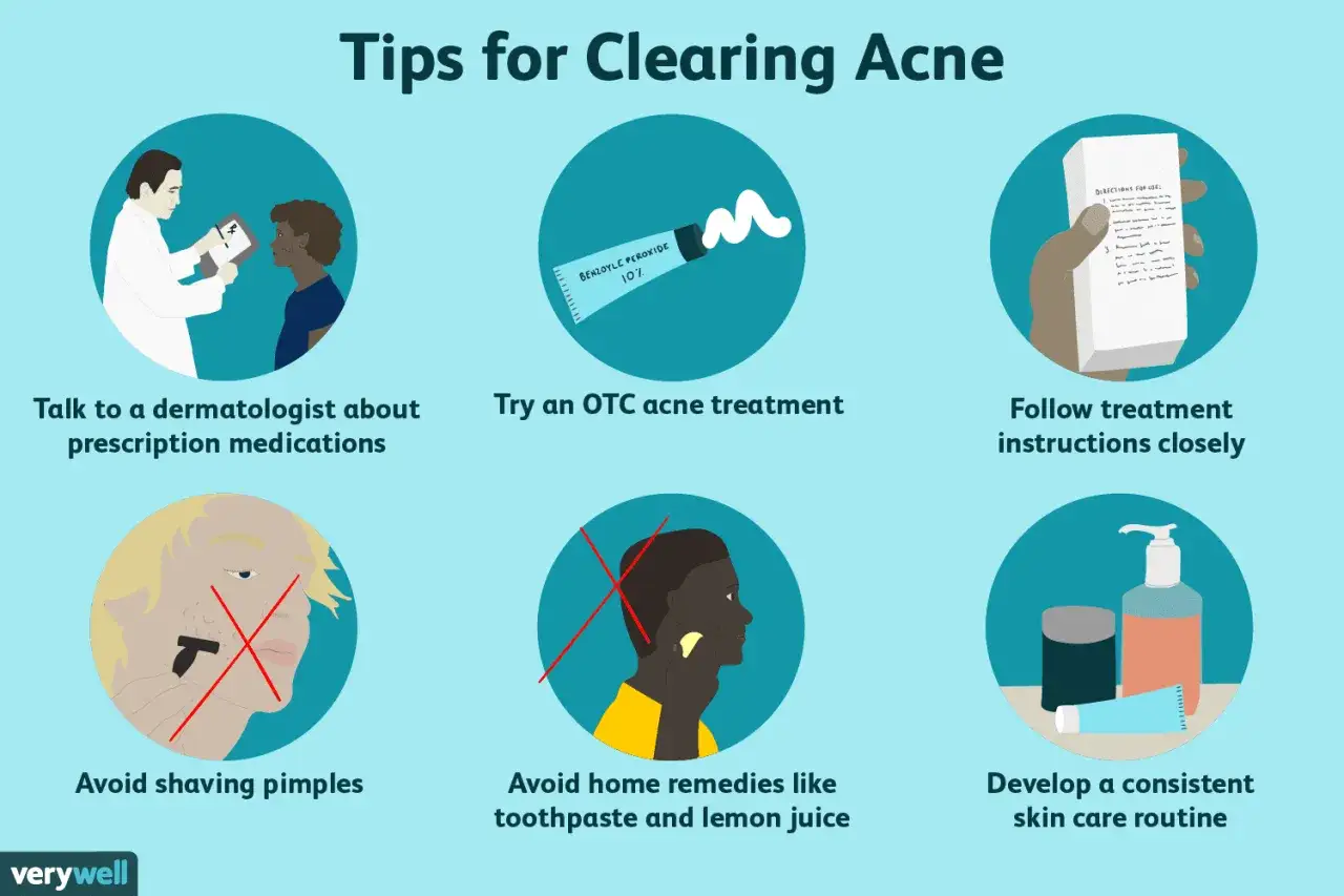 Tips för att hantera acne hos en tonåring: prata med läkare, använd receptfria medel, följ instruktioner, undvik att raka finnar, inga huskurer, och ha en hudvårdsrutin.