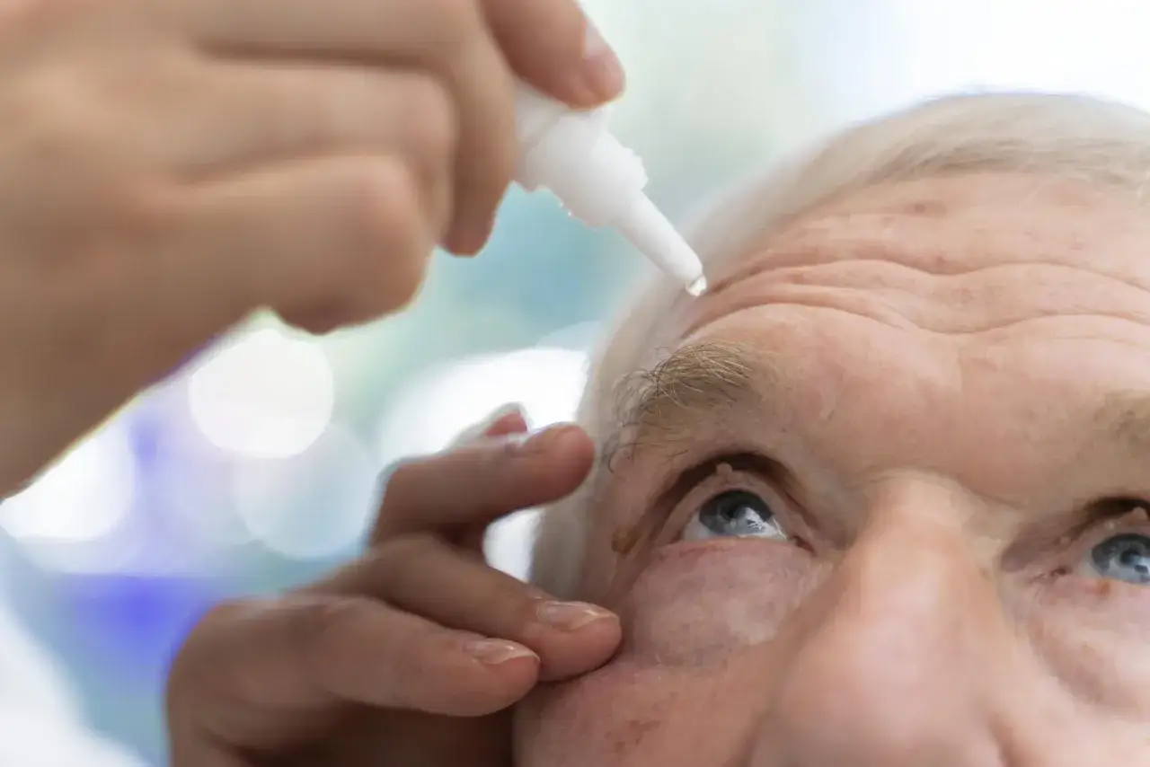 Goccia di cortisone collirio cade sull'occhio di un anziano, alleviando un disturbo.