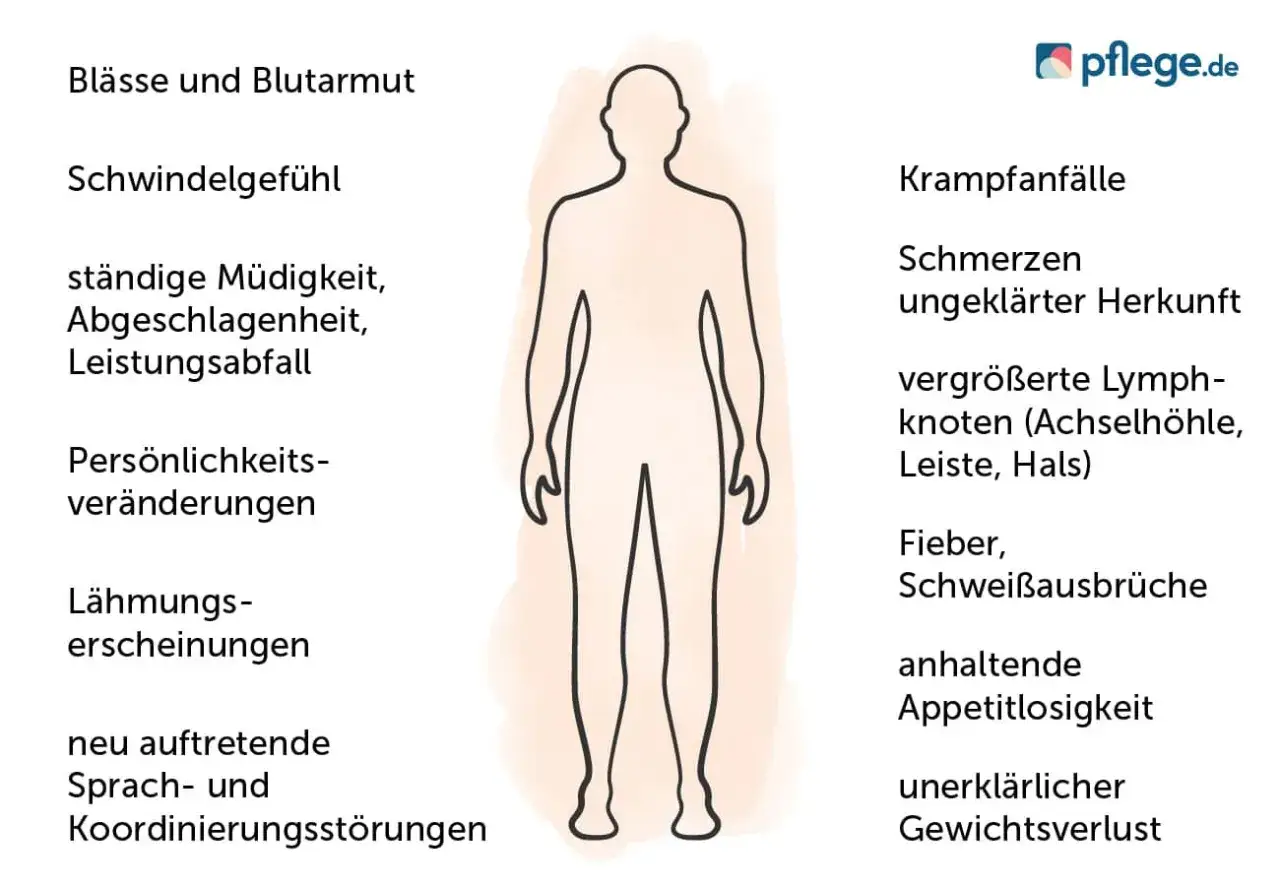 Mögliche nierenkrebs symptome: Blässe, Müdigkeit, Schmerzen, Fieber, Gewichtsverlust. Die Grafik zeigt eine menschliche Silhouette mit verschiedenen Symptomen.