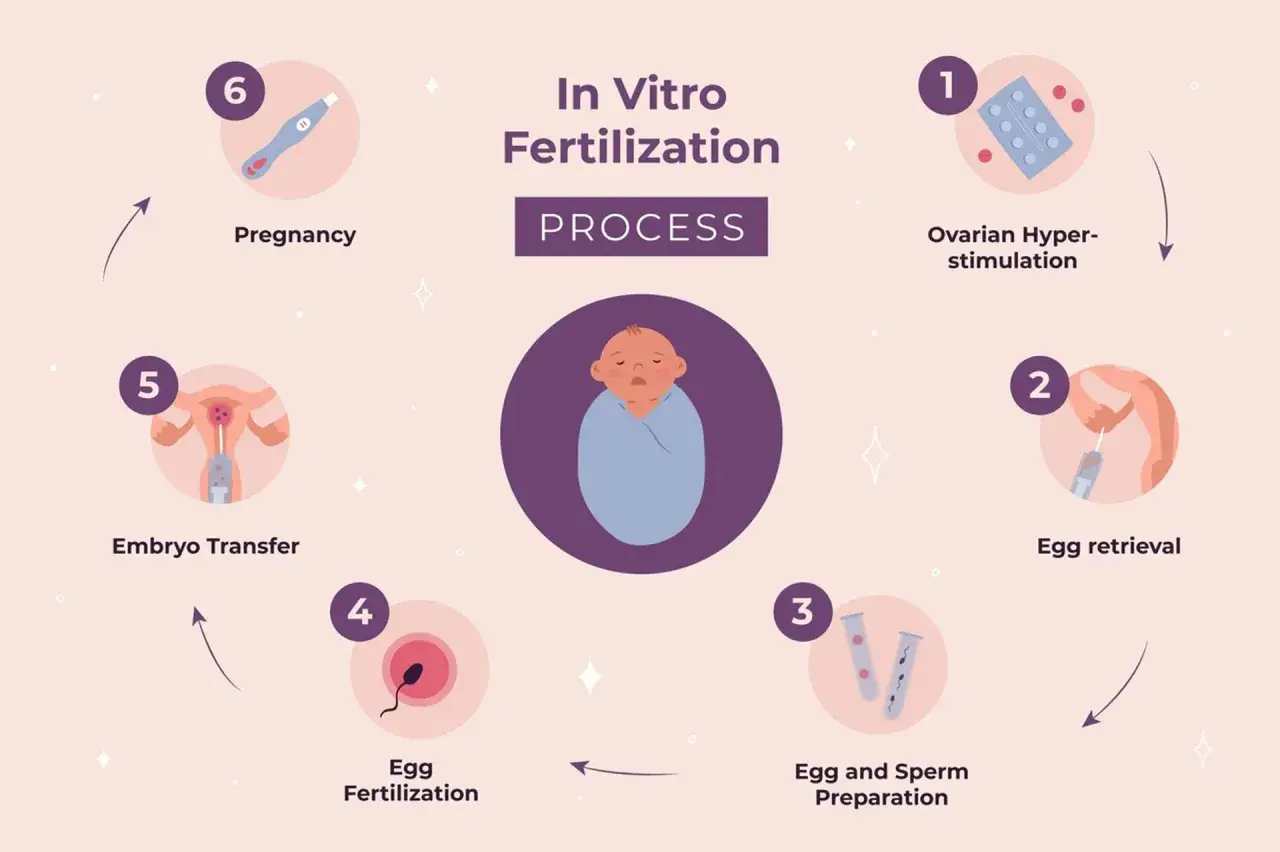 Der IVF-Prozess: Von der Stimulation &uuml;ber die Eizellentnahme bis zur Schwangerschaft. Die IVF-Bedeutung liegt in der Erf&uuml;llung des Kinderwunsches.