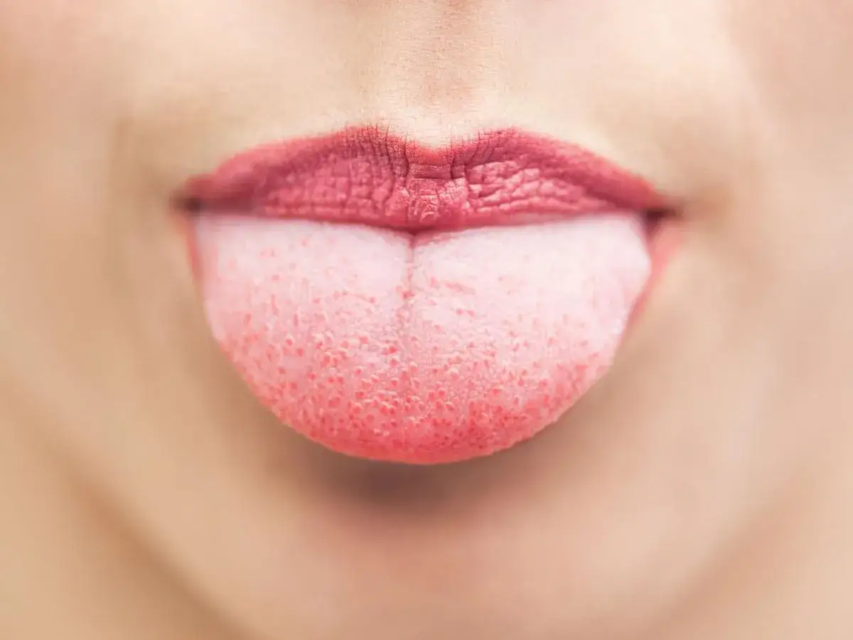 Lingua rosa con piccole vesciche visibili, che sporge tra le labbra.