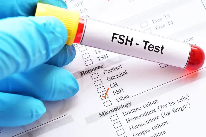 Cennik badania FSH w Polsce laboratorium