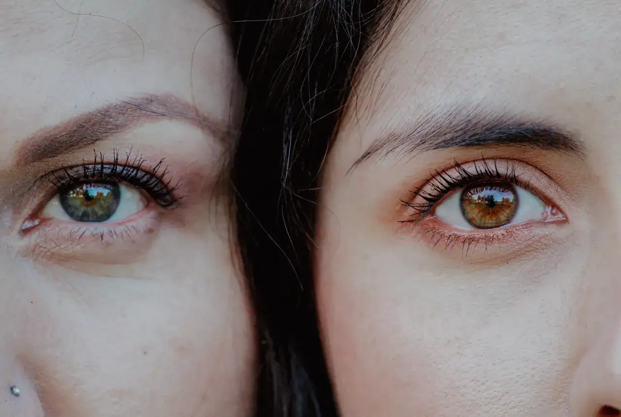 Nahaufnahme zweier Augen, eines mit gr&uuml;ner, das andere mit brauner Iris. Die Haut unter den Augen zeigt leichte Falten, was auf schlaffe Haut unter den Augen hindeutet.