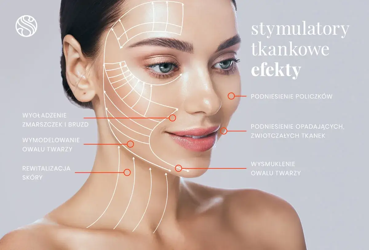 Modelka prezentuje efekty działania stymulatorów tkankowych, takich jak Profhilo: wygładzenie zmarszczek, lifting policzków i rewitalizacja skóry.