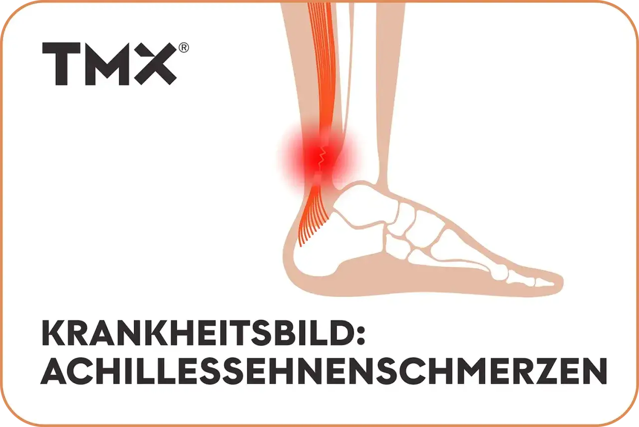 Illustration zeigt ein Bein mit rotem Bereich um die Achillessehne, der Achillessehnenschmerzen symbolisiert. TMX Logo oben links.