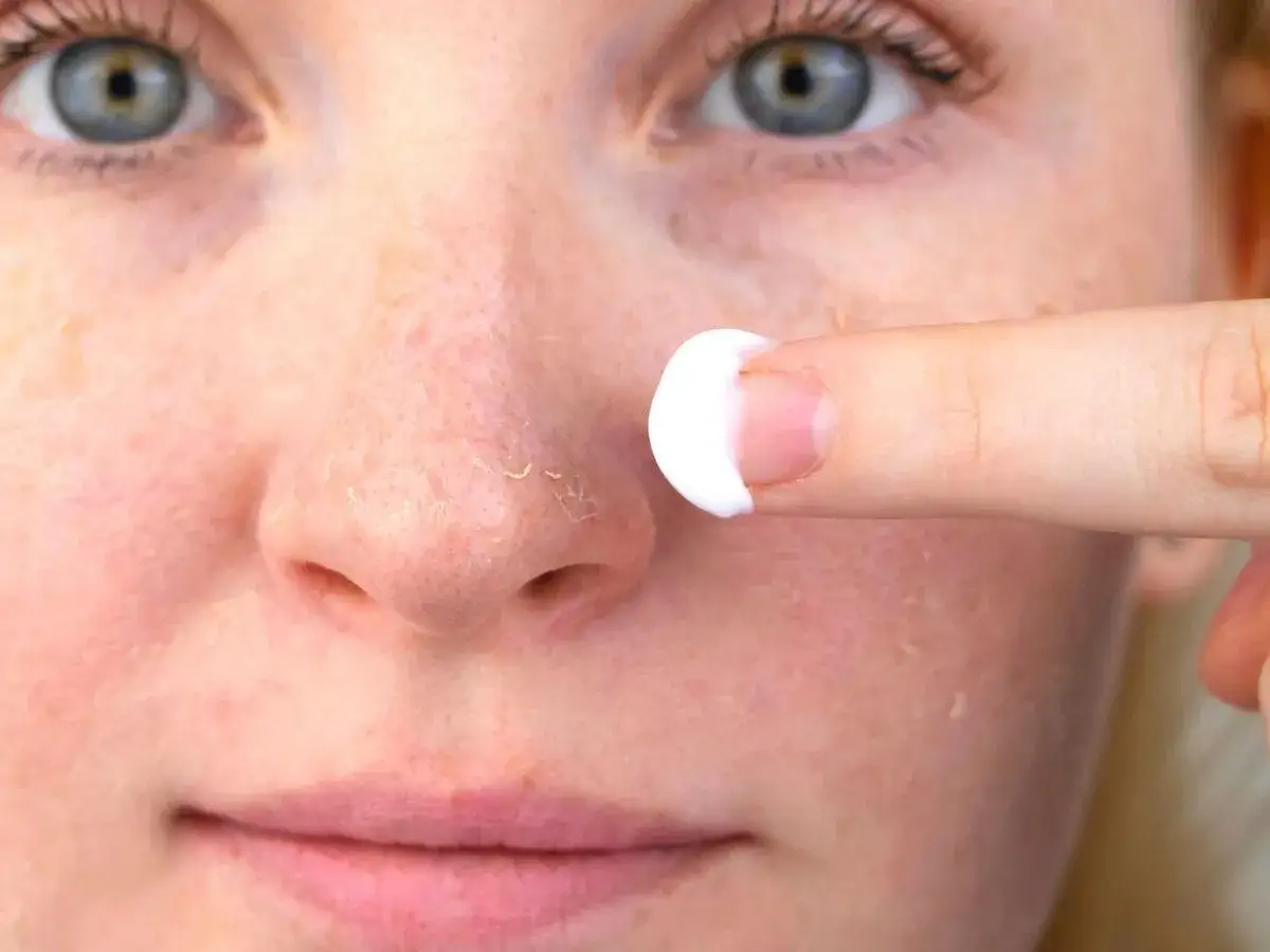 Dita con crema idratante applicata su naso con pelle secca inverno, che si sfalda.