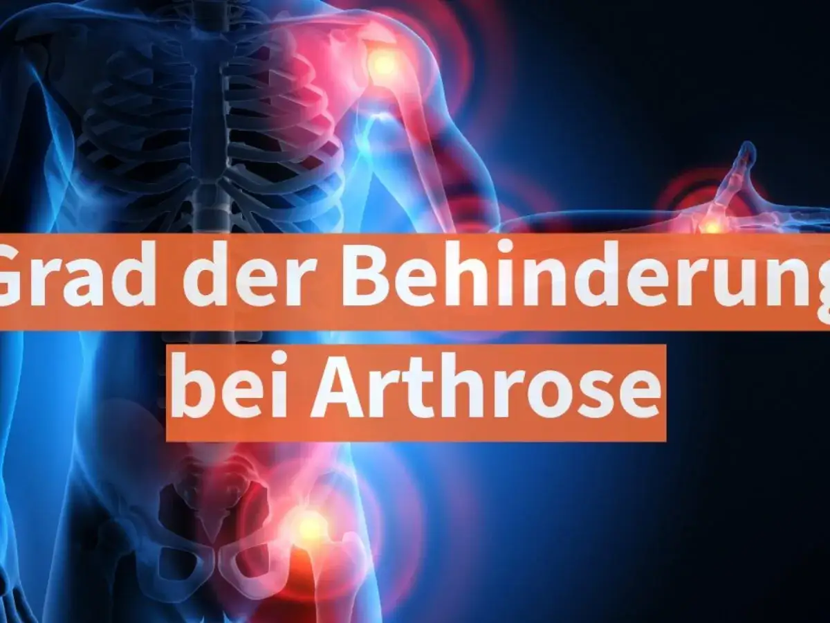 Illustration eines menschlichen Skeletts mit schmerzenden Gelenken. Text: 