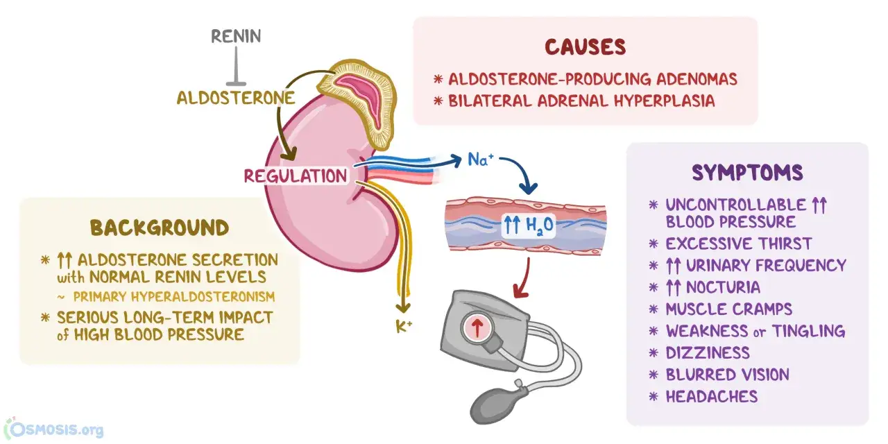 Das Bild erkl&auml;rt das Conn-Syndrom: Ursachen (Adenome, Hyperplasie), Hintergrund (Aldosteron-&Uuml;berschuss) und Symptome (Bluthochdruck, Durst, h&auml;ufiges Wasserlassen).