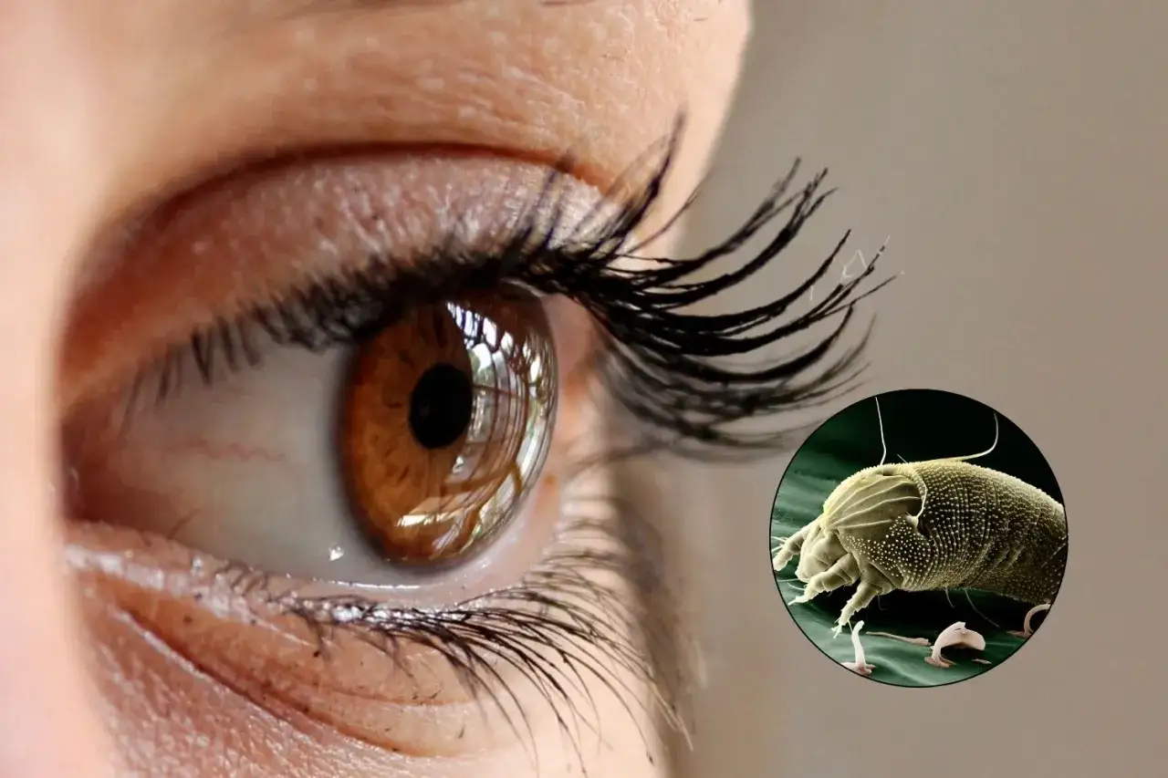 Nahaufnahme eines menschlichen Auges mit Wimpern. Daneben ein vergr&ouml;&szlig;erter Blick auf Milben am Auge, die winzige Parasiten.