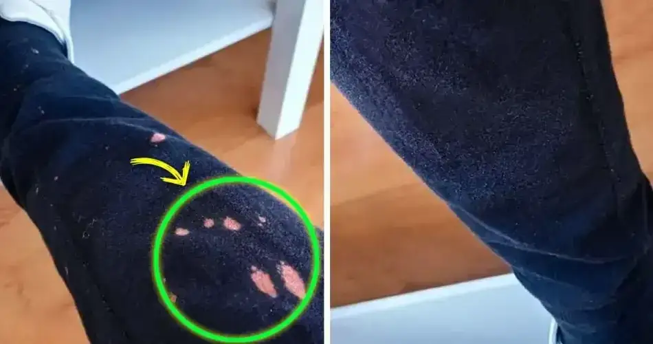 Zdjęcie Skuteczne sposoby na to, czym usunąć plamę po wybielaczu z tkanin