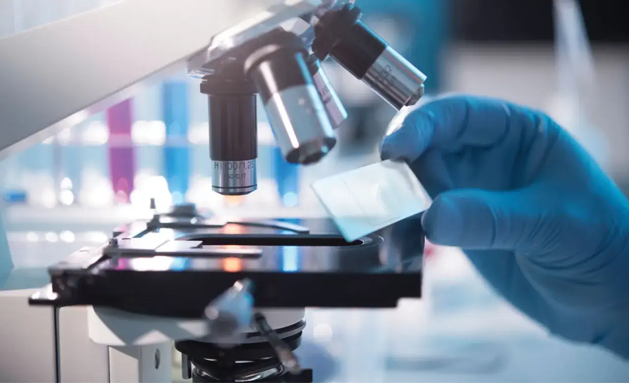 Ręka w niebieskiej rękawiczce umieszcza szkiełko mikroskopowe pod obiektywem. Na szkiełku mogą być widoczne pasma śluzu w moczu, analizowane w laboratorium.