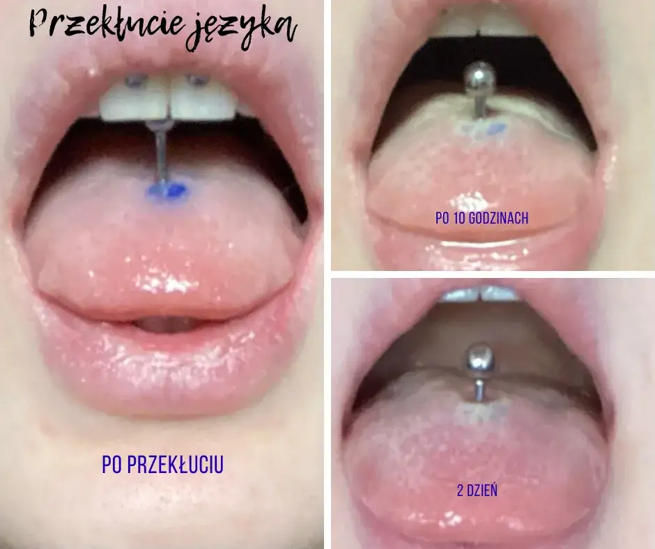 czego unikać przy gojeniu kolczyka